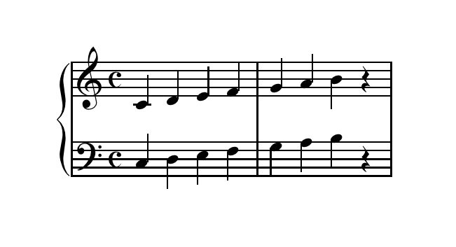 Music staff symbols
